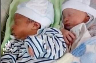 RODILA BLIZANCE, PA ZANEMELA OD ŠOKA: Lekari trčali da ih vide, otac mislio da je greška, sad imaju 5 godina i ČUDNI SU RODILA BLIZANCE, PA ZANEMELA OD ŠOKA: Lekari trčali da ih vide, otac mislio da je greška, sad imaju 5 godina i ČUDNI SU - featured image