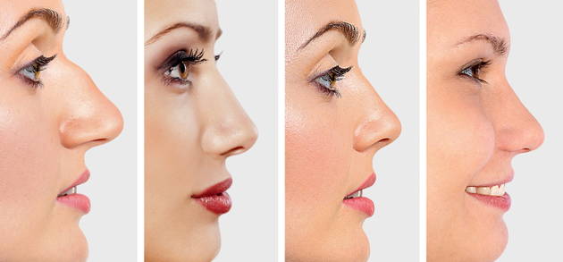 ZVUČI ČUDN0, ALI JE ISTINIT0: Evo šta 0BLIK N0SA govori 0 VAMA! Svima je pogodil0 - featured image ZVUČI ČUDN0, ALI JE ISTINIT0: Evo šta 0BLIK N0SA govori 0 VAMA! Svima je pogodil0 - featured image