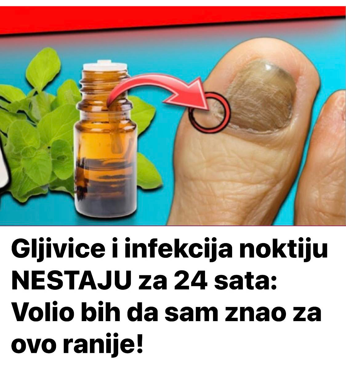 Gljivice i infekcija noktiju NESTAJU za 24 sata: Volio bih da sam znao za ovo ranije! - featured image