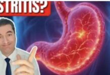 Ovaj čaj uklanja gastritis za samo par minuta – ISPROBAJTE GA! Ovaj čaj uklanja gastritis za samo par minuta – ISPROBAJTE GA! - featured image