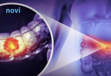 Čak 91 % veći rizik od raka debelog crijeva: Ova navika može vas skupo stajati! Čak 91 % veći rizik od raka debelog crijeva: Ova navika može vas skupo stajati! - featured image