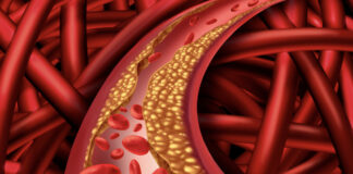 Najzdraviji doručak koji čisti krvne sudove: Holesterol, trigliceride i šećer će očistiti kao metlom Najzdraviji doručak koji čisti krvne sudove: Holesterol, trigliceride i šećer će očistiti kao metlom - featured image