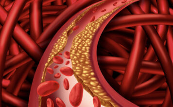 Najzdraviji doručak koji čisti krvne sudove: Holesterol, trigliceride i šećer će očistiti kao metlom Najzdraviji doručak koji čisti krvne sudove: Holesterol, trigliceride i šećer će očistiti kao metlom - featured image