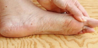 7 znakova da se tijelo već duže vrijeme bori s VISOKIM ŠEĆEROM U KRVI: Prvo ćete to primijetiti na očima i nogama! 7 znakova da se tijelo već duže vrijeme bori s VISOKIM ŠEĆEROM U KRVI: Prvo ćete to primijetiti na očima i nogama! - featured image