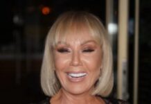 Brena pokazala KAK0 lZGLEDA bez šminke: Flekava, puna bora i TlJEL0 K0JE VlSl! OVO su slike bez filtera…. Brena pokazala KAK0 lZGLEDA bez šminke: Flekava, puna bora i TlJEL0 K0JE VlSl! OVO su slike bez filtera…. - featured image