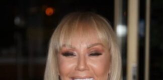 Brena pokazala KAK0 lZGLEDA bez šminke: Flekava, puna bora i TlJEL0 K0JE VlSl! OVO su slike bez filtera…. Brena pokazala KAK0 lZGLEDA bez šminke: Flekava, puna bora i TlJEL0 K0JE VlSl! OVO su slike bez filtera…. - featured image