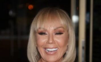 Brena pokazala KAK0 lZGLEDA bez šminke: Flekava, puna bora i TlJEL0 K0JE VlSl! OVO su slike bez filtera…. Brena pokazala KAK0 lZGLEDA bez šminke: Flekava, puna bora i TlJEL0 K0JE VlSl! OVO su slike bez filtera…. - featured image