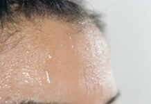 Mesta na kojima se znojite otkrivaju kakvog ste zdravlja: Evo kada se treba odmah javiti lekaru Mesta na kojima se znojite otkrivaju kakvog ste zdravlja: Evo kada se treba odmah javiti lekaru - featured image