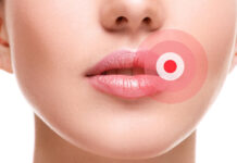 Ako ste ga ikada imali OVO u ustima, trebali bi znati šta je u pitanju, i kako da se toga riješite.. Ako ste ga ikada imali OVO u ustima, trebali bi znati šta je u pitanju, i kako da se toga riješite.. - featured image