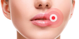 Ako ste ga ikada imali OVO u ustima, trebali bi znati šta je u pitanju, i kako da se toga riješite.. Ako ste ga ikada imali OVO u ustima, trebali bi znati šta je u pitanju, i kako da se toga riješite.. - featured image