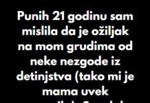“Punih 21 godinu sam mislila da je ožiljak na mom grudima od neke nezgode iz detinjstva…” “Punih 21 godinu sam mislila da je ožiljak na mom grudima od neke nezgode iz detinjstva…” - featured image