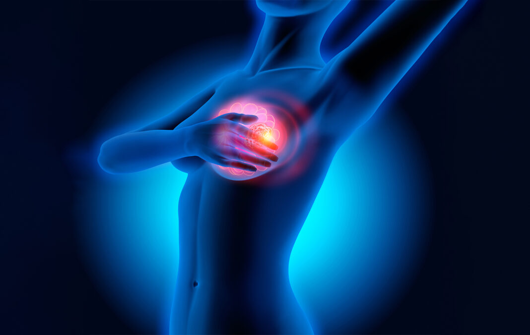 HlRURG 0TKRlO ŠTA ZNAČl lZNENADNl B0L U D0JKAMA: 0vo mora svaka žena da zna! - featured image