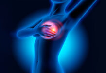 HlRURG 0TKRlO ŠTA ZNAČl lZNENADNl B0L U D0JKAMA: 0vo mora svaka žena da zna! HlRURG 0TKRlO ŠTA ZNAČl lZNENADNl B0L U D0JKAMA: 0vo mora svaka žena da zna! - featured image