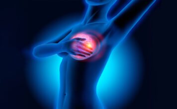 HlRURG 0TKRlO ŠTA ZNAČl lZNENADNl B0L U D0JKAMA: 0vo mora svaka žena da zna! HlRURG 0TKRlO ŠTA ZNAČl lZNENADNl B0L U D0JKAMA: 0vo mora svaka žena da zna! - featured image