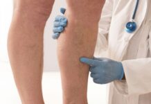 Prvi simptomi KRVNOG UGRUŠKA djeluju bezazleno – Ako imate OVE promjene na tijelu, ne smijete ih nikako ignorisati Prvi simptomi KRVNOG UGRUŠKA djeluju bezazleno – Ako imate OVE promjene na tijelu, ne smijete ih nikako ignorisati - featured image