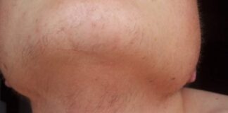 EVO ZAŠTO ŽENE IMAJU DLAKAVU BRADU! Ovo vam organizam govori! EVO ZAŠTO ŽENE IMAJU DLAKAVU BRADU! Ovo vam organizam govori! - featured image