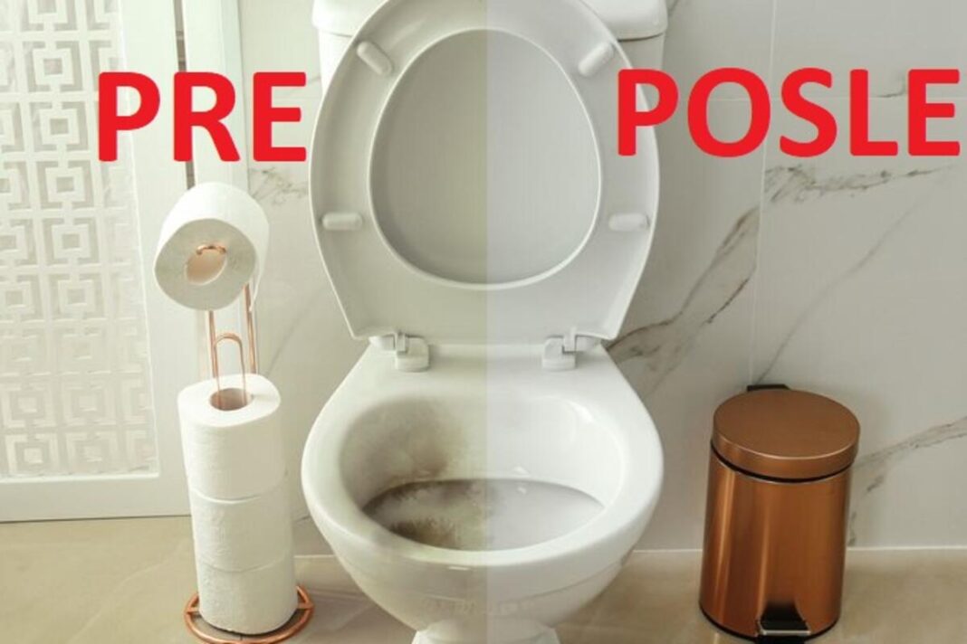 Nije sirće ni soda bikarbona: Ovo sredstvo najbolje uklanja kamenac u WC šolji - featured image