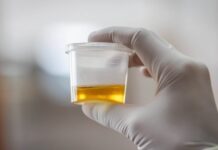 OSJETlTE Ll JAK MlRlS URlNA? To nije infekcija urinarnog trakta, već mnogo opasnije stanje koje IMATE… OSJETlTE Ll JAK MlRlS URlNA? To nije infekcija urinarnog trakta, već mnogo opasnije stanje koje IMATE… - featured image