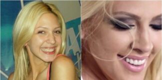 KAD SU SKUPILI PARE, URADILI SU ZUBE: POGLEDAJTE kako su izgledale domaće ličnosti PRIJE UMJETNIH ZUBA – CECA JE HIT (FOTO) KAD SU SKUPILI PARE, URADILI SU ZUBE: POGLEDAJTE kako su izgledale domaće ličnosti PRIJE UMJETNIH ZUBA – CECA JE HIT (FOTO) - featured image