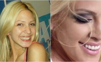 KAD SU SKUPILI PARE, URADILI SU ZUBE: POGLEDAJTE kako su izgledale domaće ličnosti PRIJE UMJETNIH ZUBA – CECA JE HIT (FOTO) KAD SU SKUPILI PARE, URADILI SU ZUBE: POGLEDAJTE kako su izgledale domaće ličnosti PRIJE UMJETNIH ZUBA – CECA JE HIT (FOTO) - featured image