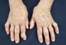 Jedan od glavnih uzroka reume nalazi se u ovoj namirnici: Sadrži opasnu bakteriju koja ubrzava ovu bolest Jedan od glavnih uzroka reume nalazi se u ovoj namirnici: Sadrži opasnu bakteriju koja ubrzava ovu bolest - featured image