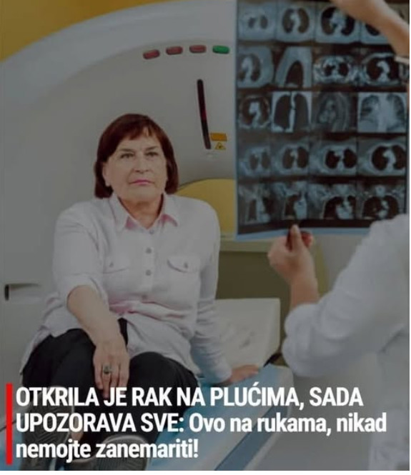 OTKRILA JE RAK NA PLUĆIMA, SADA UPOZORAVA SVE: Ovo na rukama, nikad nemojte zanemariti! - featured image OTKRILA JE RAK NA PLUĆIMA, SADA UPOZORAVA SVE: Ovo na rukama, nikad nemojte zanemariti! - featured image