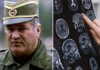 Sve bolesti od kojih je bolovao Ratko Mladić: Ovi simptomi ne smeju da se ignorišu, mogu biti kobni Sve bolesti od kojih je bolovao Ratko Mladić: Ovi simptomi ne smeju da se ignorišu, mogu biti kobni - featured image