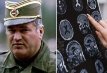 Sve bolesti od kojih je bolovao Ratko Mladić: Ovi simptomi ne smeju da se ignorišu, mogu biti kobni Sve bolesti od kojih je bolovao Ratko Mladić: Ovi simptomi ne smeju da se ignorišu, mogu biti kobni - featured image