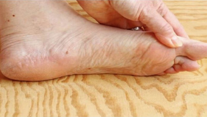 Kako tijelo upozorava na dugo povišen šećer u krvi: sedam znakova koje ljudi najprije primijete na očima i nogama - featured image Kako tijelo upozorava na dugo povišen šećer u krvi: sedam znakova koje ljudi najprije primijete na očima i nogama - featured image