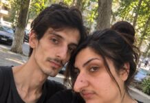 Godinama su se ljudi rugali mom nosu, a nakon operacije moj je muž uklonio sva ogledala iz naše kuće — ali kada je netko pokucao na vrata, otkrila sam tko je zapravo svih tih godina učinio da se toliko sramim svog izgleda… Godinama su se ljudi rugali mom nosu, a nakon operacije moj je muž uklonio sva ogledala iz naše kuće — ali kada je netko pokucao na vrata, otkrila sam tko je zapravo svih tih godina učinio da se toliko sramim svog izgleda… - featured image
