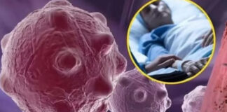 8 namirnica koje smanjuju upale i jačaju imunitet — savršen početak dana 8 namirnica koje smanjuju upale i jačaju imunitet — savršen početak dana - featured image