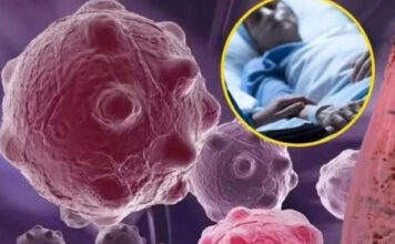 8 namirnica koje smanjuju upale i jačaju imunitet — savršen početak dana 8 namirnica koje smanjuju upale i jačaju imunitet — savršen početak dana - featured image