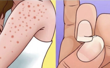 Simptomi koje ne treba ignorisati: Stručnjaci upozoravaju na moguće rane znakove ozbiljnih bolesti Simptomi koje ne treba ignorisati: Stručnjaci upozoravaju na moguće rane znakove ozbiljnih bolesti - featured image