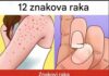 Simptomi koje ne treba ignorisati: Stručnjaci upozoravaju na moguće rane znakove ozbiljnih bolesti Simptomi koje ne treba ignorisati: Stručnjaci upozoravaju na moguće rane znakove ozbiljnih bolesti - featured image