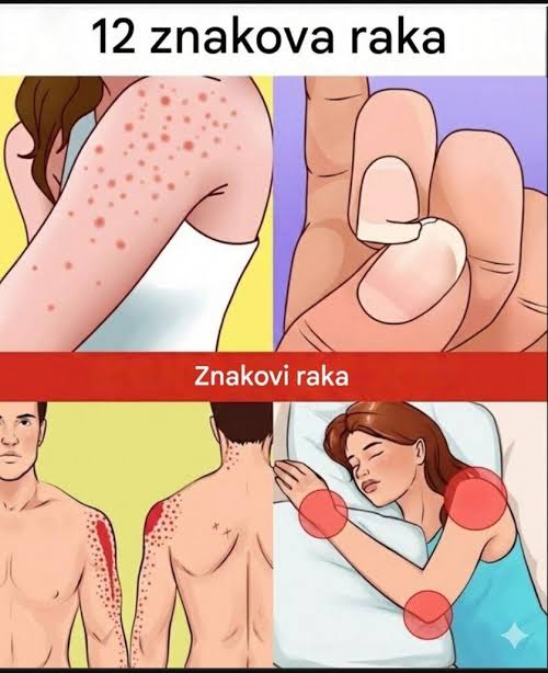 Simptomi koje ne treba ignorisati: Stručnjaci upozoravaju na moguće rane znakove ozbiljnih bolesti - featured image Simptomi koje ne treba ignorisati: Stručnjaci upozoravaju na moguće rane znakove ozbiljnih bolesti - featured image